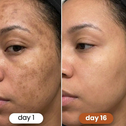 Turmeric + Kojic Acid Pads