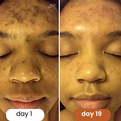 Turmeric + Kojic Acid Pads