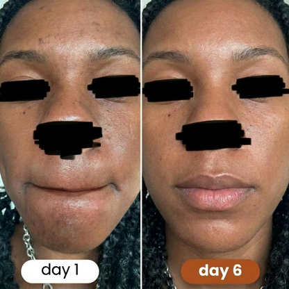 Turmeric + Kojic Acid Pads