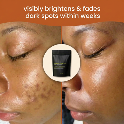 Turmeric + Kojic Acid Pads